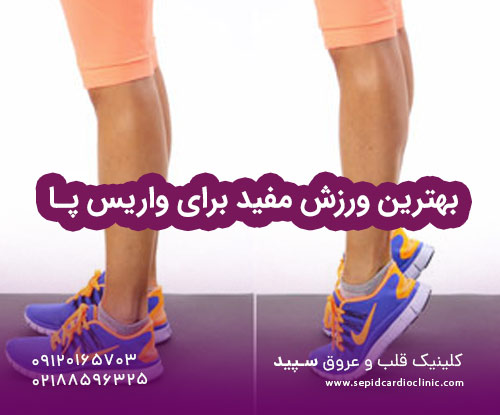 بهترین ورزش مفید برای واریس پا