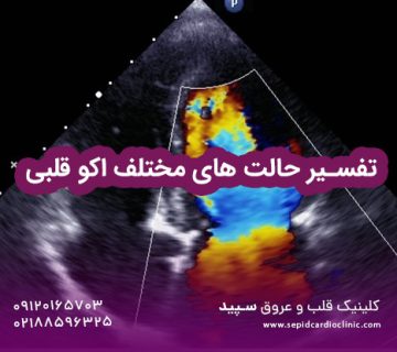 تفسیر حالت های مختلف اکو قلبی