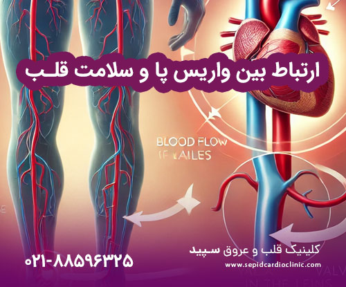 ارتباط بین واریس پا و سلامت قلب