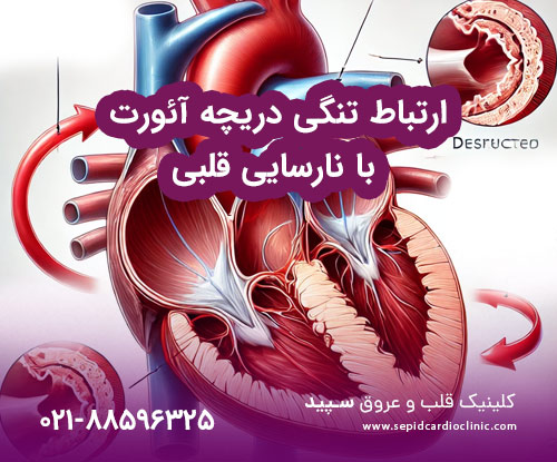 ارتباط تنگی دریچه آئورت با نارسایی قلبی