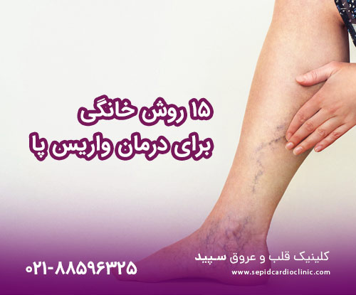 ۱۵ روش خانگی برای درمان واریس پا