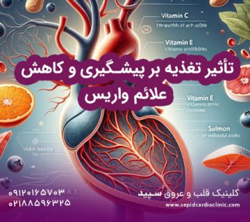 تأثیر تغذیه بر پیشگیری و کاهش علائم واریس