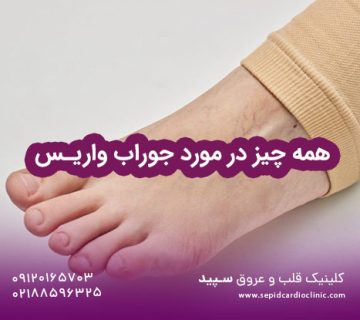 همه چیز در مورد جوراب واریس