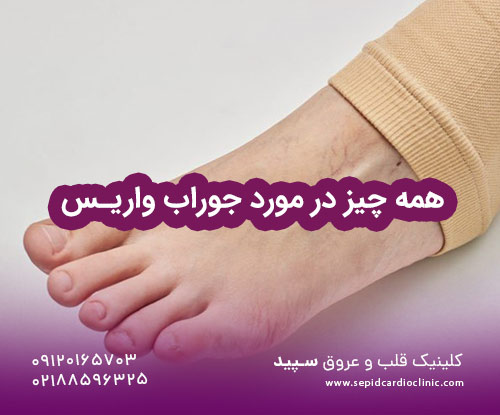 همه چیز در مورد جوراب واریس