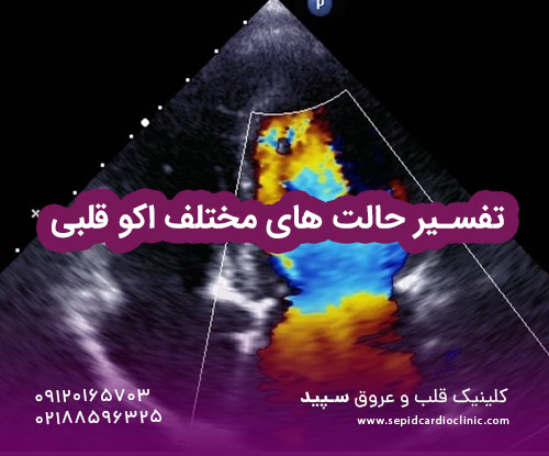 تفسیر حالت های مختلف اکو قلبی