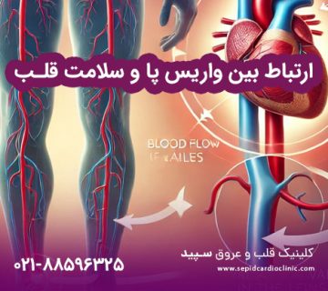 ارتباط بین واریس پا و سلامت قلب