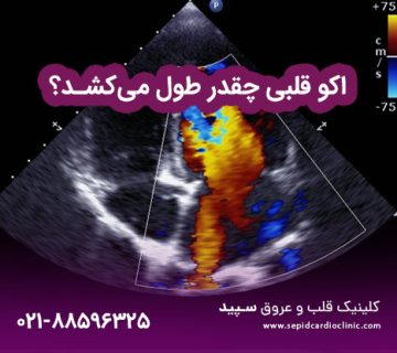 اکو قلبی چقدر طول می‌کشد؟