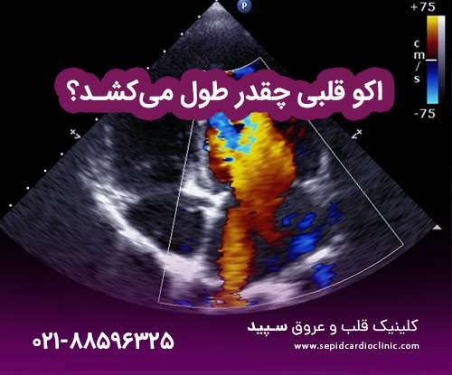 اکو قلبی چقدر طول می‌کشد؟