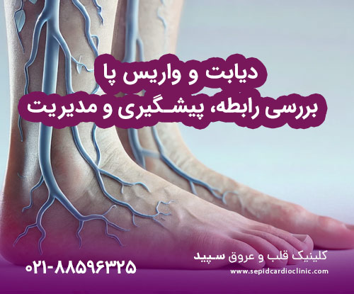 دیابت و واریس پا و بررسی رابطه، پیشگیری و مدیریت